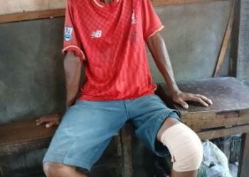 Tak Punya BPJS, Penarik Becak di Medan Enam Bulan Menderita Patah Lutut