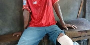 Tak Punya BPJS, Penarik Becak di Medan Enam Bulan Menderita Patah Lutut